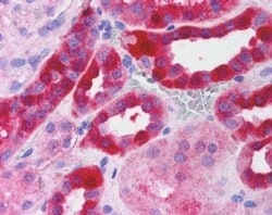 Invitrogen RICTOR Polyclonal Antibody 100 &mu;g; Unconjugated:Antibodies,