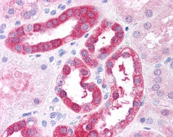Invitrogen RICTOR Polyclonal Antibody 100 &mu;g; Unconjugated:Antibodies,