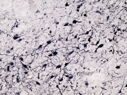 Invitrogen Tyrosine Hydroxylase Polyclonal Antibody 100 &mu;g; Unconjugated:Antibodies,