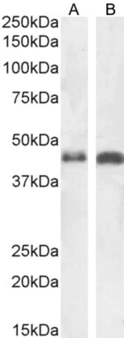 Invitrogen beta-Arrestin 2 Polyclonal Antibody 100 &mu;g; Unconjugated:Antibodies,