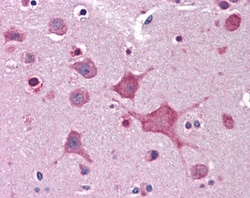 Invitrogen DPP10 Polyclonal Antibody 100 &mu;g; Unconjugated:Antibodies,