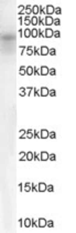 Invitrogen DPP10 Polyclonal Antibody 100 &mu;g; Unconjugated:Antibodies,