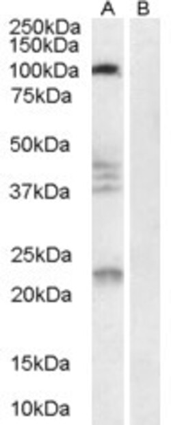 Invitrogen Nogo Receptor Polyclonal Antibody 100 &mu;g; Unconjugated:Antibodies,