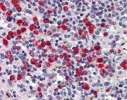 Invitrogen NGAL Polyclonal Antibody 100 μg; Unconjugated:Antibodies,