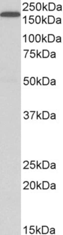 Invitrogen LRP5 Polyclonal Antibody 100 &mu;g; Unconjugated:Antibodies,