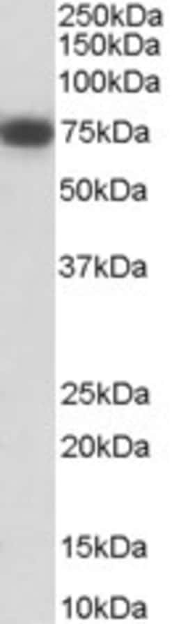 Invitrogen NGFR Polyclonal Antibody 100 &mu;g | Buy Online | Invitrogen&trade; | Fisher Scientific