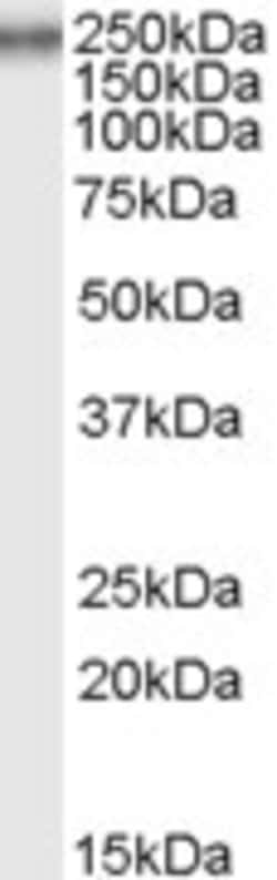 Invitrogen COL7A1 Polyclonal Antibody 100 &mu;g | Buy Online | Invitrogen&trade; | Fisher Scientific
