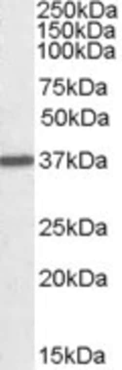 Invitrogen Arginase 1 Polyclonal Antibody 100 &mu;g; Unconjugated:Antikörper
