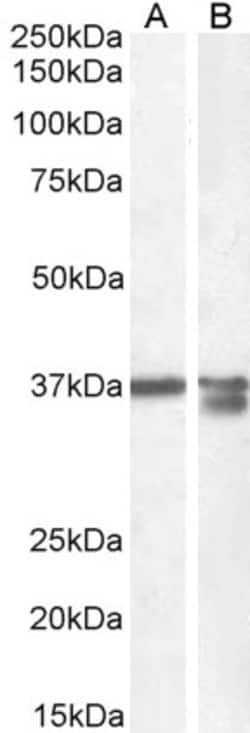 Invitrogen Arginase 1 Polyclonal Antibody 100 &mu;g; Unconjugated:Antikörper