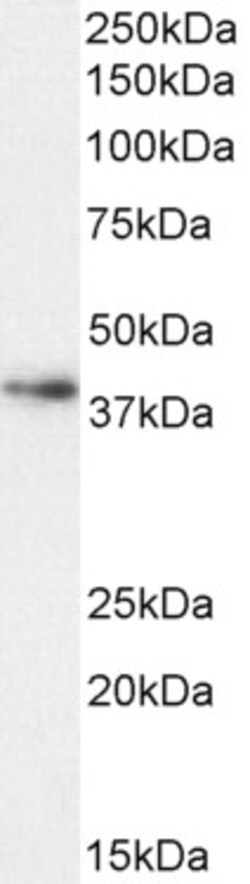 Invitrogen Arginase 1 Polyclonal Antibody 100 &mu;g; Unconjugated:Antikörper