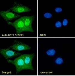 Invitrogen GSTP1 Polyclonal Antibody 100 &mu;g; Unconjugated:Antibodies,