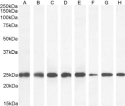 Invitrogen GSTP1 Polyclonal Antibody 100 &mu;g; Unconjugated:Antibodies,