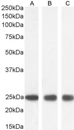 Invitrogen GSTP1 Polyclonal Antibody 100 &mu;g; Unconjugated:Antibodies,