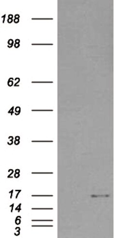 Invitrogen SH2D1A Polyclonal Antibody 100 &mu;g; Unconjugated:Antibodies,