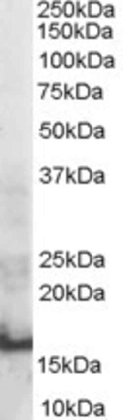Invitrogen SH2D1A Polyclonal Antibody 100 &mu;g; Unconjugated:Antibodies,