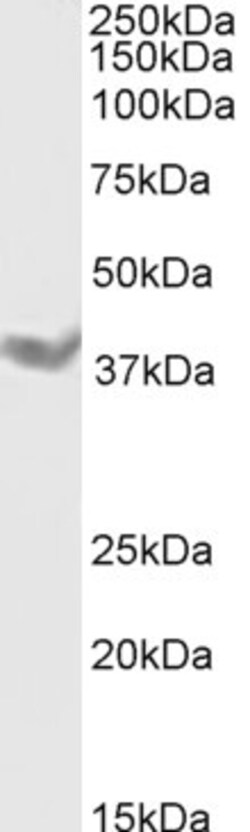 Invitrogen DAZL Polyclonal Antibody 100 &mu;g; Unconjugated:Antibodies,