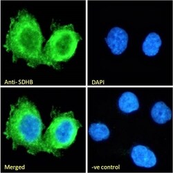 Invitrogen SDHB Polyclonal Antibody 100 &mu;g; Unconjugated:Antibodies,