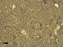 Invitrogen SDHB Polyclonal Antibody 100 &mu;g; Unconjugated:Antibodies,