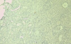 Invitrogen SDHB Polyclonal Antibody 100 &mu;g; Unconjugated:Antibodies,