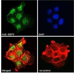 Invitrogen MEFV Polyclonal Antibody 100 μg; Unconjugated:Antibodies,