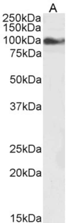 Invitrogen TRPC6 Polyclonal Antibody 100 &mu;g; Unconjugated:Antibodies,