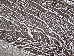 Invitrogen LDB3 Polyclonal Antibody 100 &mu;g; Unconjugated:Antibodies,