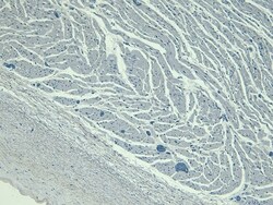 Invitrogen LDB3 Polyclonal Antibody 100 &mu;g; Unconjugated:Antibodies,