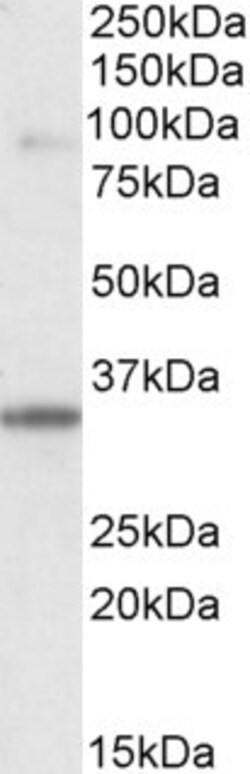 Invitrogen LDB3 Polyclonal Antibody 100 &mu;g; Unconjugated:Antibodies,