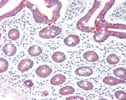 Invitrogen MAOA Polyclonal Antibody 100 &mu;g; Unconjugated:Antibodies,