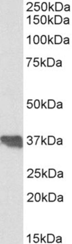 Invitrogen Apolipoprotein J Polyclonal Antibody 100 &mu;g | Buy Online | Invitrogen&trade; | Fisher Scientific