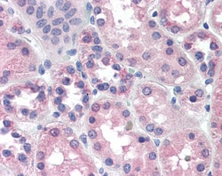 Invitrogen PCK1 Polyclonal Antibody 100 &mu;g; Unconjugated:Antibodies,