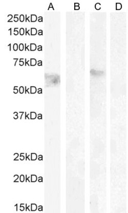 Invitrogen Cannabinoid Receptor 1 Polyclonal Antibody 100 &mu;g; Unconjugated:Antibodies,