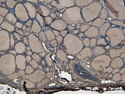 Invitrogen ENPP1 Polyclonal Antibody 100 &mu;g; Unconjugated:Antibodies,