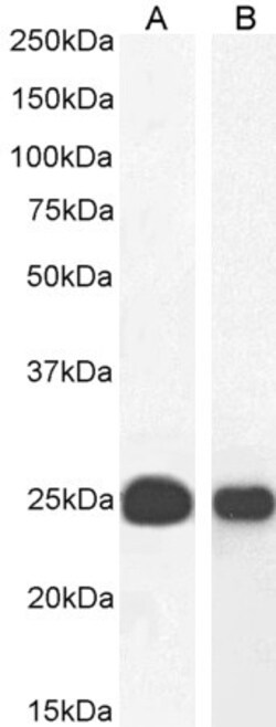 Invitrogen HP1 alpha Polyclonal Antibody 100 &mu;g; Unconjugated:Antistoffer
