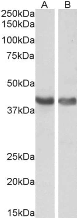 Invitrogen HEXIM1 Polyclonal Antibody 100 &mu;g; Unconjugated:Antibodies,