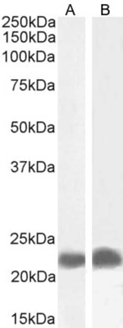 Invitrogen TIRAP Polyclonal Antibody 100 &mu;g; Unconjugated:Antibodies,