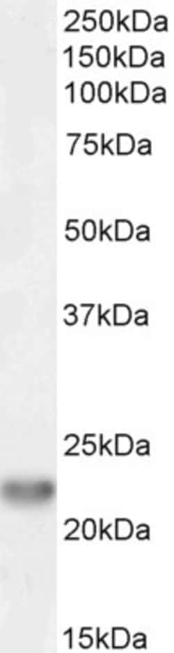 Invitrogen TIRAP Polyclonal Antibody 100 &mu;g; Unconjugated:Antibodies,