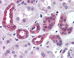 Invitrogen SUPT16H Polyclonal Antibody 100 μg; Unconjugated:Antibodies,