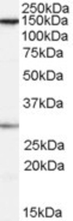 Invitrogen SUPT16H Polyclonal Antibody 100 μg; Unconjugated:Antibodies,