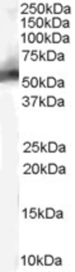 Invitrogen MDM2 Polyclonal Antibody 100 &mu;g; Unconjugated:Antibodies,