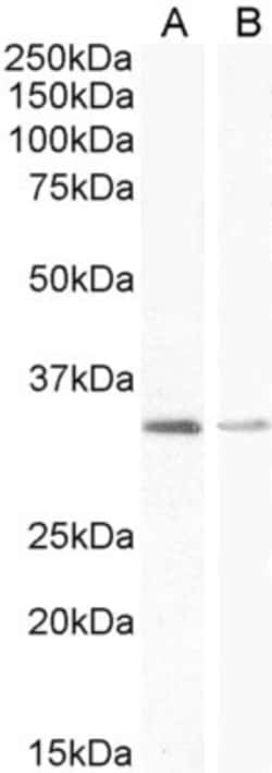 Invitrogen UCP1 Polyclonal Antibody 100 &mu;g; Unconjugated:Antibodies,