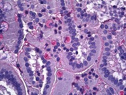 Invitrogen NTN1 Polyclonal Antibody 100 μg; Unconjugated:Antibodies,