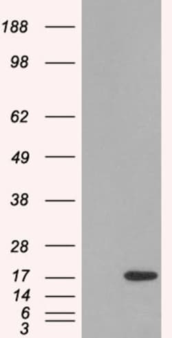 Invitrogen SH2D1A Polyclonal Antibody 100 &mu;g; Unconjugated:Antibodies,