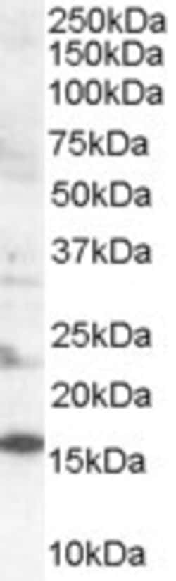 Invitrogen SH2D1A Polyclonal Antibody 100 &mu;g; Unconjugated:Antibodies,