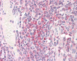 Invitrogen RPS19 Polyclonal Antibody 100 &mu;g; Unconjugated:Antibodies,
