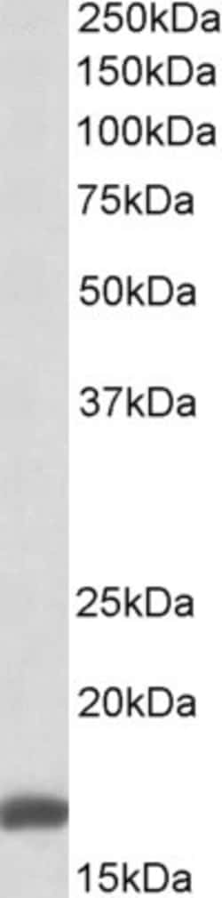 Invitrogen RPS19 Polyclonal Antibody 100 &mu;g; Unconjugated:Antibodies,