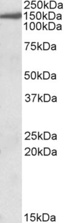 Invitrogen EPB41L3 Polyclonal Antibody 100 &mu;g; Unconjugated:Antibodies,