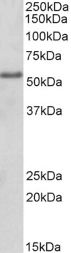 Invitrogen FOXC1 Polyclonal Antibody 100 &mu;g; Unconjugated:Antibodies,