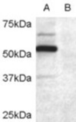 Invitrogen DCDC2 Polyclonal Antibody 100 &mu;g | Buy Online | Invitrogen&trade; | Fisher Scientific