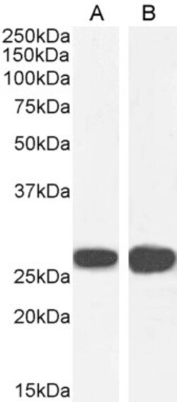 Invitrogen 14-3-3 sigma Polyclonal Antibody 100 &mu;g; Unconjugated:Antibodies,